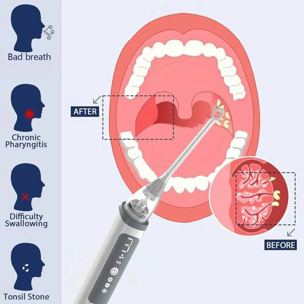 Routine avec bain de bouche Caseocare